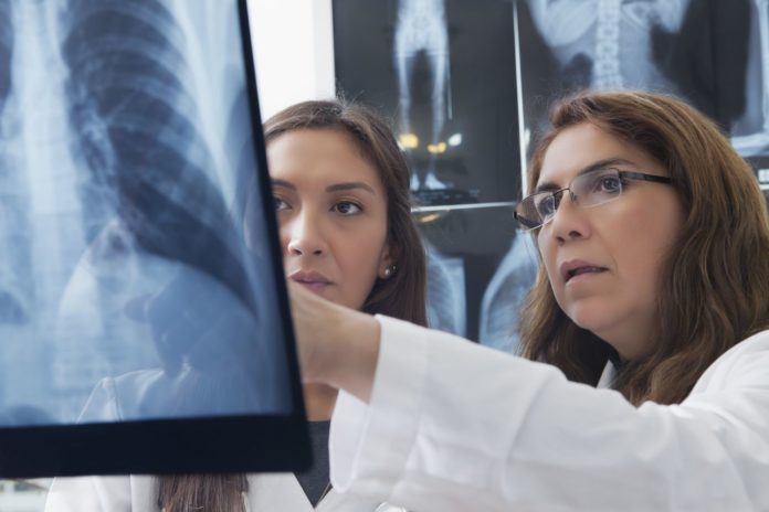hispanic-doctors-examining-x-ray-of-chest-726778315-5ae9bd3fa474be003604110d